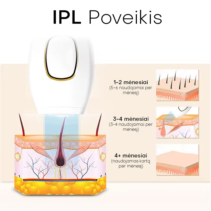 Lunero™ Plaukelių Šalinimas