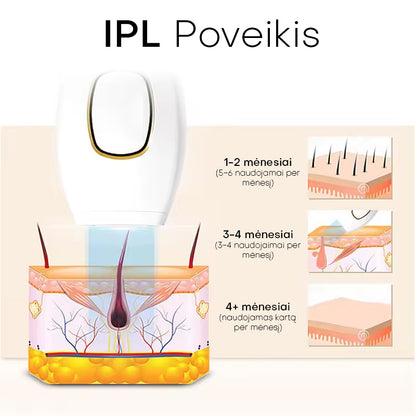 Lunero™ Plaukelių Šalinimas